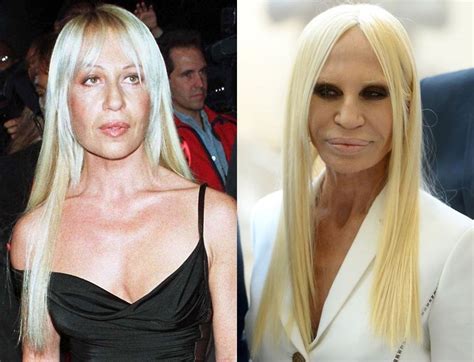 donatella versace d repubblica|donatella versace before and after surgery.